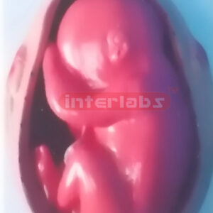 UTERUS WITH EMBRYO (10 MONTH)