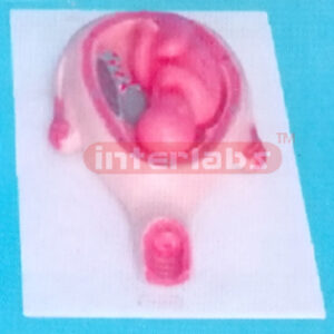 UTERUS WITH EMBRYO (8 MONTHS)