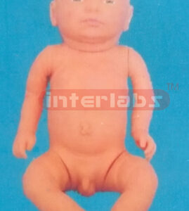 THE STANDARD BORN FETUS (A TYPE)