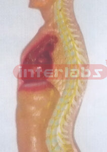 ADVANCED HANGING PLATE, SPINAL CORD MODEL IN SPINAL CANAL