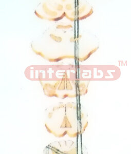 THE PAIN, THALPOTIC AND PSELAPHESIC CONDUCTIVE PATHWAYS MODEL OF THE TRUNK AND LIMBS