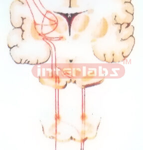 HANGING EXTRAPYRAMIDAL SYSTEM MODEL (CORPUS STRIATUM-GLOBUS PALLIDUS)