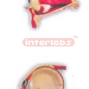 EYE MUSCLES OF THE ORBIT
