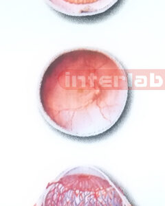 HANGING HUMAN HORIZONTAL SECTION MODEL OF THE EYEBALL