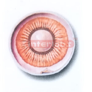 ANTERIOR PART OF THE EYEBALL (INTER-NAL ASPECT) MODEL