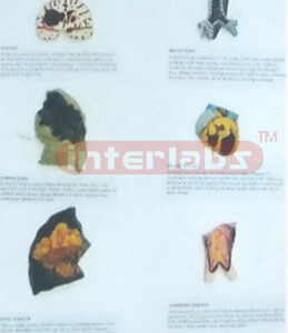 MIDDLE HUMAN THE CONSEQUENCES OF SMOKING. HANGING WOODEN PLATE (B TYPE)
