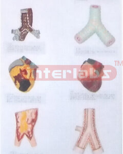 HANGING HUMAN COMPARISION MODEL BETWEEN HEALTH ORGANS AND SMOKING