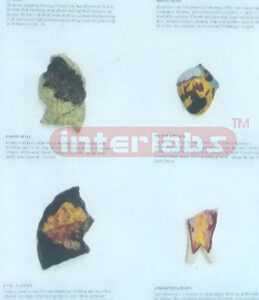 HUMAN THE CONSEQUENCES OF SMOKING HANGING WOODEN PLATE