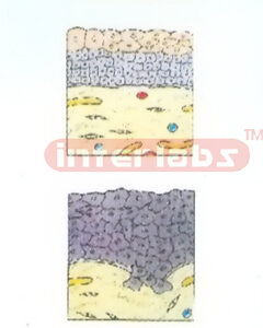 HANGING THE SMOKING ENDANGERS LUNG MODEL