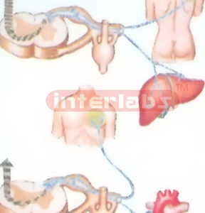 DISEASE REFLEX COLLECTION