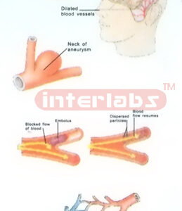 HUMAN YOUNG HAEMORRHAGE MODEL FOR DEMONSTRATING