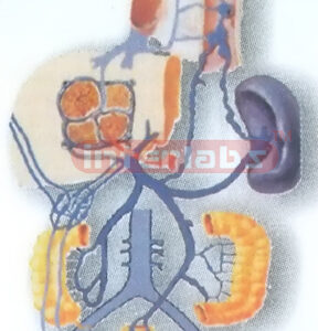 HUMAN PORTAL VEIN HYPERTENSION COLLATERAL CIRCULATION FORMING & DEMONSTRATING MODEL