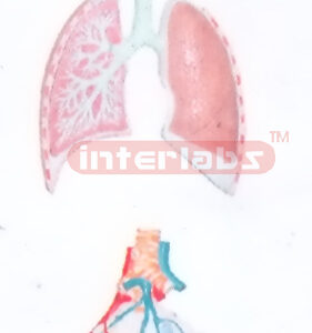 HUMAN RESPIRATORY SYSTEM WITH HANGING ENLARGED ALVEOLI (RELIEF)