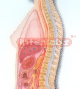 HANGING FEMALE INNER ORGANS MODEL IN ABDOMINAL CAVITY