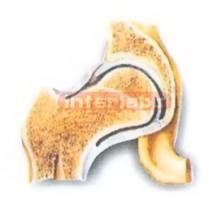 HUMAN HIP JOINT (CORONAL SECTION) MODEL