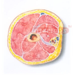 HUMAN TRANSVERSE SECTION MODEL THROUGH THE PORXIMAL 1/3 OF THE RIGHT ARM (A)