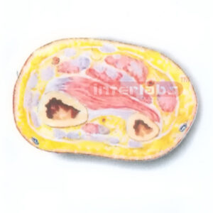 HUMAN TRANSVERSE SECTION MODEL THROUGH THE DISTAL 1/3 OF RIGHT FOREARM (C)