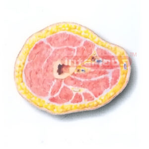 HUMAN TRANSVERSE SECTION MODEL THROUGH THE PROXIMAL 1/3 OF THE RIGHT THIGH (B)