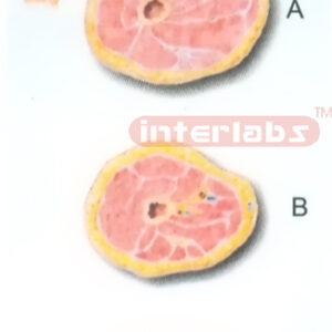 HUMAN TRANSVERSE SECTION THROUGH THE PROXIMAL 1/3 OF THE RIGHT THIGH (A, B, C)
