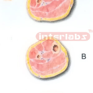 HUMAN TRANSVERSE SECTION THROUGH THE DISTAL 1/3 OF THE RIGHT LEG (A, B, C)