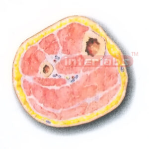 TRANSVERSE SECTION MODEL THROUGH THE MIDDLE 1/3 OF THE RIGHT LEG (B)