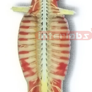 HITCH-HANGING, HUMAN SPINAL CORD MODEL IN SPINAL CANAL