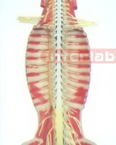 SMALL HANGING HUMAN SPINAL CORD MODEL IN SPINAL CANAL