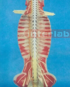 SMALL HUMAN SPINAL CORD MODEL IN SPINAL CANAL