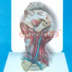 DESK- TYPE, HUMAN HEAD & NECK DISTRIBUTION MODEL FOR MAIN ARTERY WITH DESCRIPTION PLATE