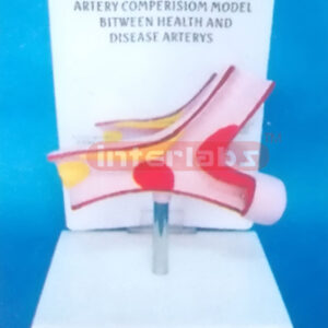DISEASE ARTERY MODEL