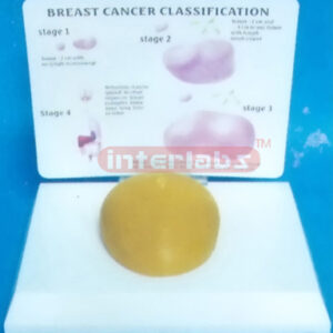DESK TYPE, CANCER CLASSIFICATION MODEL WITH DESCRIPITON PLATE