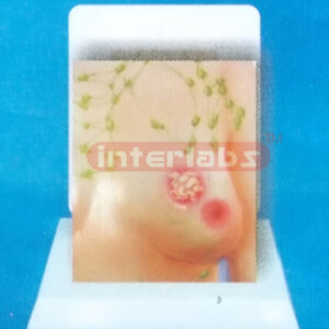 DESK MANARY TUMOR EVOLUTION MODEL WI DESCRIPTION PLATE (2)