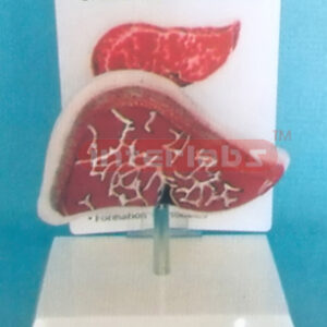 DESK-TYPE, CHRONIC HEPATITIS MODEL WITH DESCRIPTION PLATE