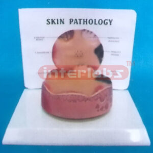 DESK-TYPE COMMON PATHOLOGIES MODEL OF SKIN CARC-INOMASERIES WITH DESCRIPTION PLATE