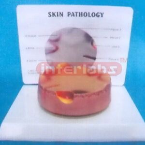 DESKTYPE COMMON PATHOLOGIES MODEL OF WOUND SERIES WITH DESCRIPTION PLATE