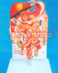 DESK-TYPE, HUMAN COMMON DISEASES OF THE DIGESTIVE SYSTEM MODEL WITH DESCRIPTION PLATE