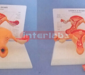 DESK TYPE, COMMON PATHOLOGIES UTERUS & OVARY WITH DESCRIPTION PLATE (2PCS) WITH COVER AND THE LESSER LIPS OF PUDENDUM