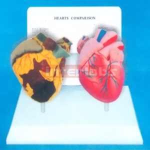 DESK-TYPE, HEART MODEL FOR COMPARISION DEMONSTRATING HEALTH MAN THAN SMOKING MAN WITH DESCRIPTION PLATE