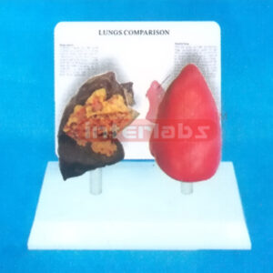 DESK-TYPE, LANGS MODEL FOR COMPARISION DEMONSTRATING HEALTHMAN THE SMOKING MAN WITH DESCRIPTION PLATE