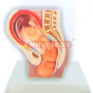 DESK-TYPE,THE POSITION MODEL OF THE CHILD BEFORE BIRTH WITH DESCRIPTION PLATE