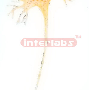 MULTI POLAR NEURON