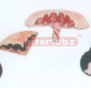 MODEL OF FOETAL ADJUNCT