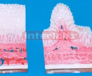 STOMACH VILLI ORGANISE MODEL