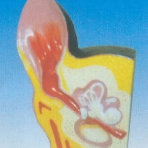 EXPANSION MODEL OF DOG EAR