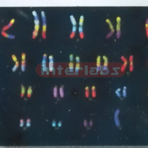 BODY CHROMATIN