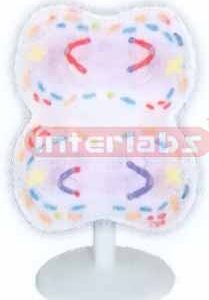 ANIMAL MITOSIS TYPE I
