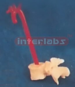 ARCUS AORTAE PEN