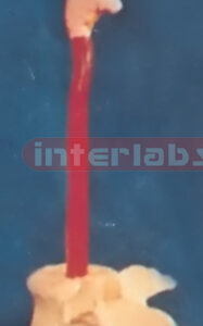 STOMACH TUBE PEN