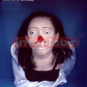 Nose cut off with knife