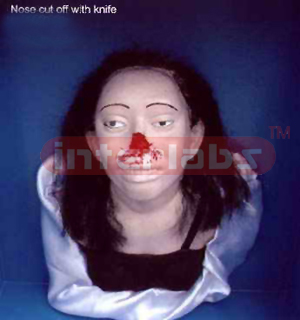 Nose cut off with knife